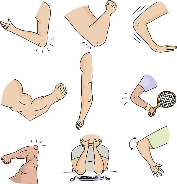 Series of Elbows