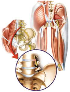 Anterior Hip Treatment All-Pro Orthopedics