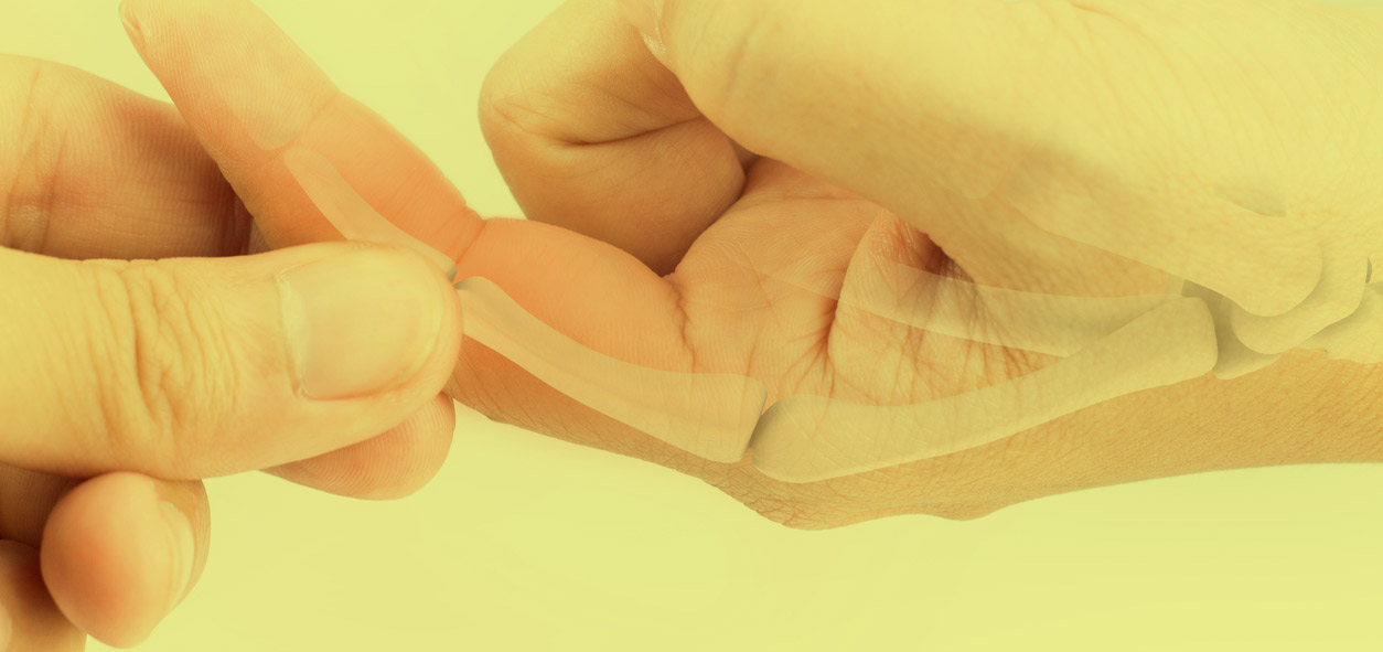 How to Treat a Broken Finger