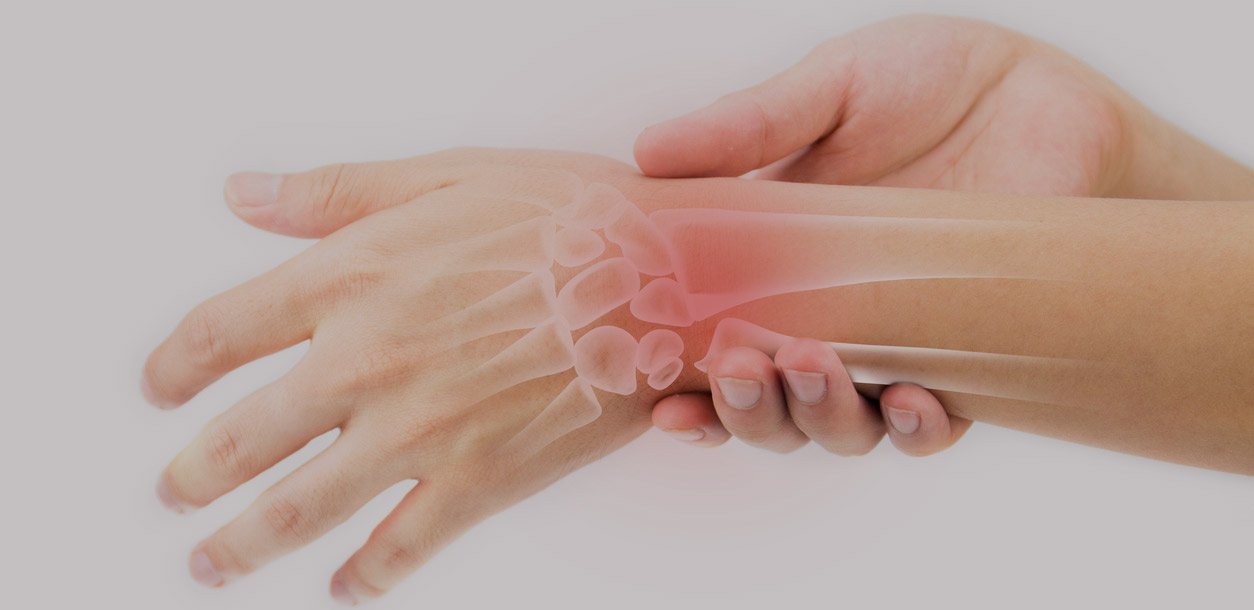 What You Need to Know about Distal Radius Fractures