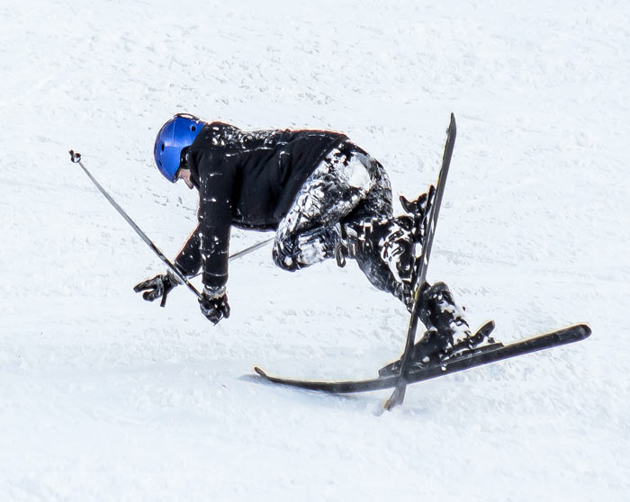 ski injury