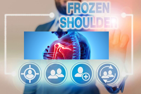 Did Your Frozen Shoulder Symptoms Worsen During COVID-19 Lockdowns?