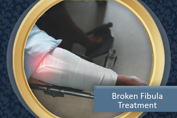 Broken Fibula Treatment