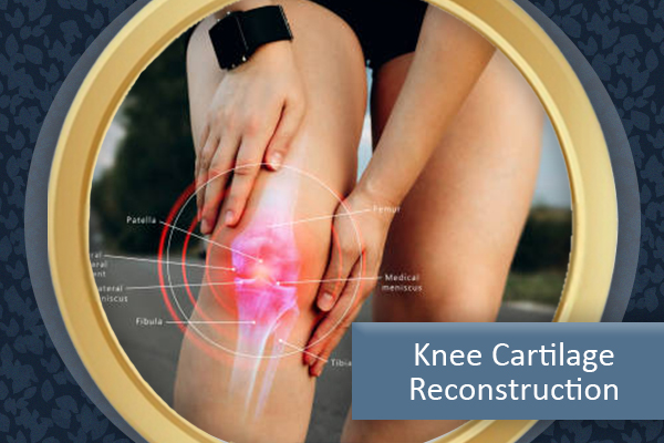 Knee Cartilage Reconstruction