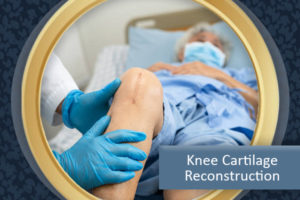 Knee Cartilage Reconstruction Pembroke Pines FL 